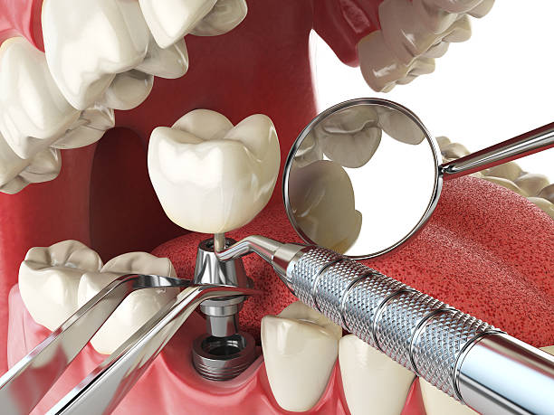 Best Emergency Dental Care for Trauma or Injury in Beachwood, NJ